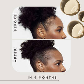 Goddess Strength Hair Regrowth Treatment